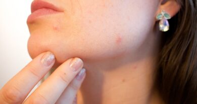 Types of Acne, Symptoms and Treatments